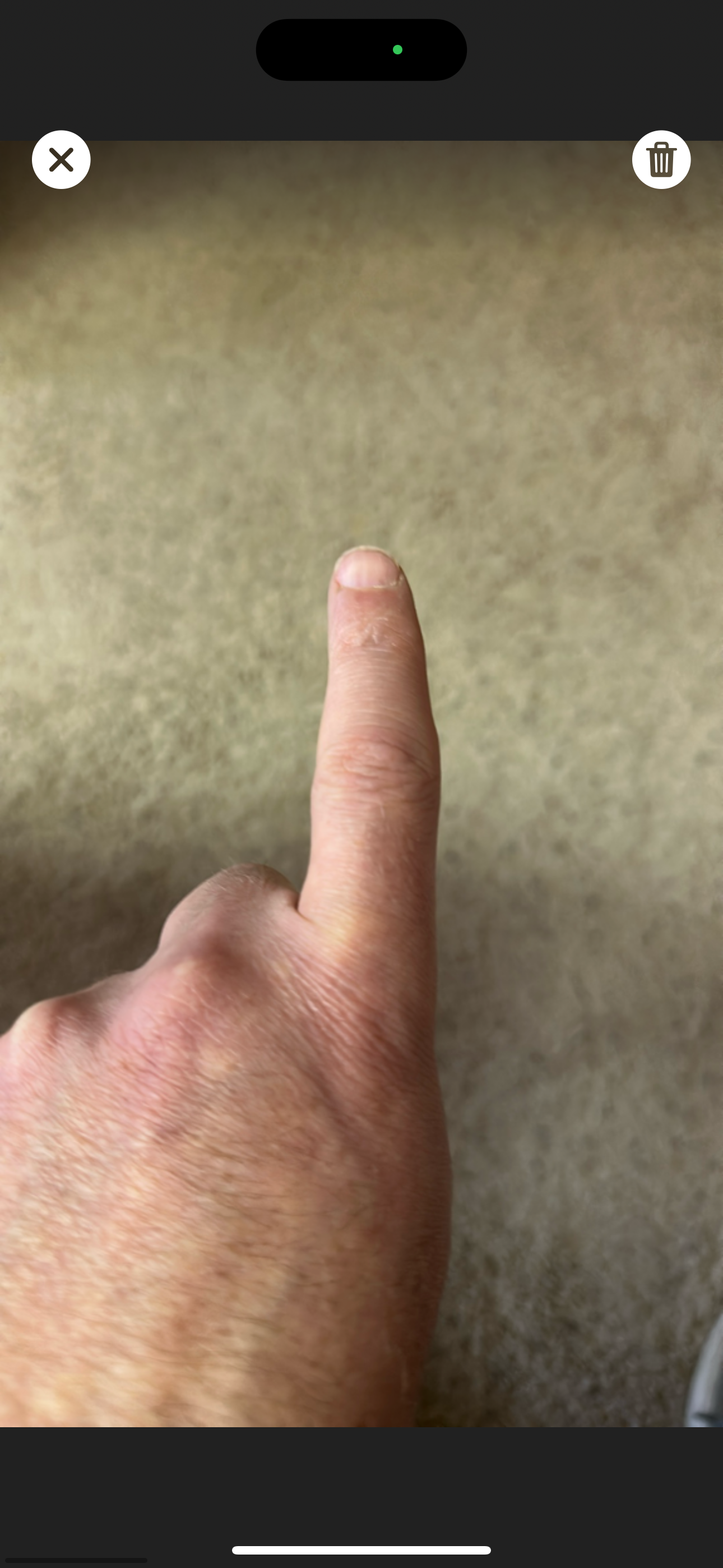 One_finger_gallery_View